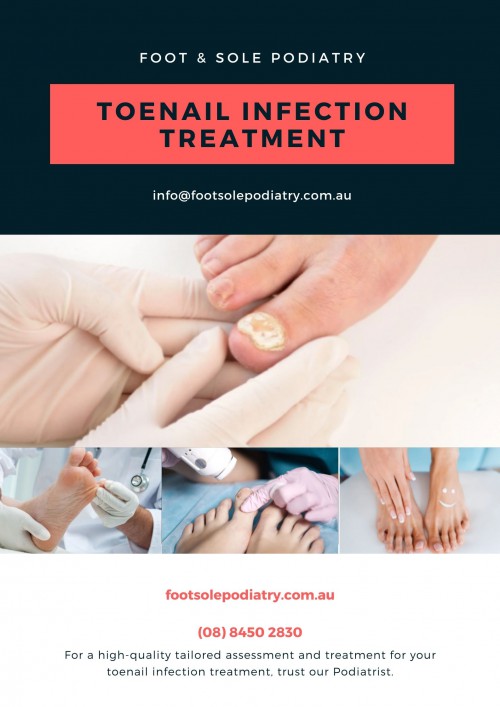 Toenail-Infection-Treatment.jpg